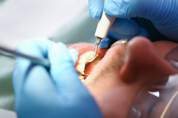 Best Pediatric Emergency Dentist in New Castle, CO