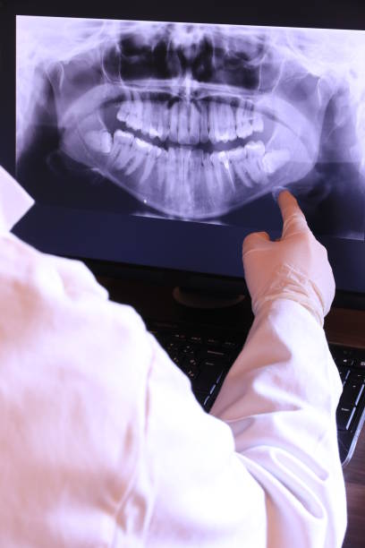 Best Emergency Broken Tooth Repair in New Castle, CO