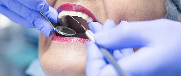 Professional Emergency Dentist in CO